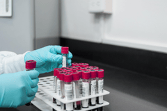 Ống nghiệm, test tube, hóa chất, chemicals, nghiên cứu, research- fernandozhiminaicela
