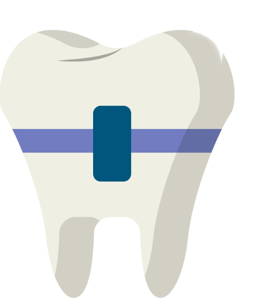 Răng niềng, nha khoa, sức khỏe, răng hàm, mắc cài, chỉnh nha, màu trắng, màu xanh, Tooth with braces, dentistry, health, molar, brackets, orthodontics, white, blue