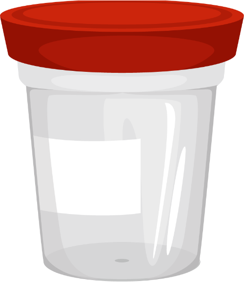 Cốc thử nghiệm, y tế, xét nghiệm, nắp đỏ, nhựa trong suốt, bệnh viện, Specimen cup, medical, test, red lid, transparent plastic, hospital