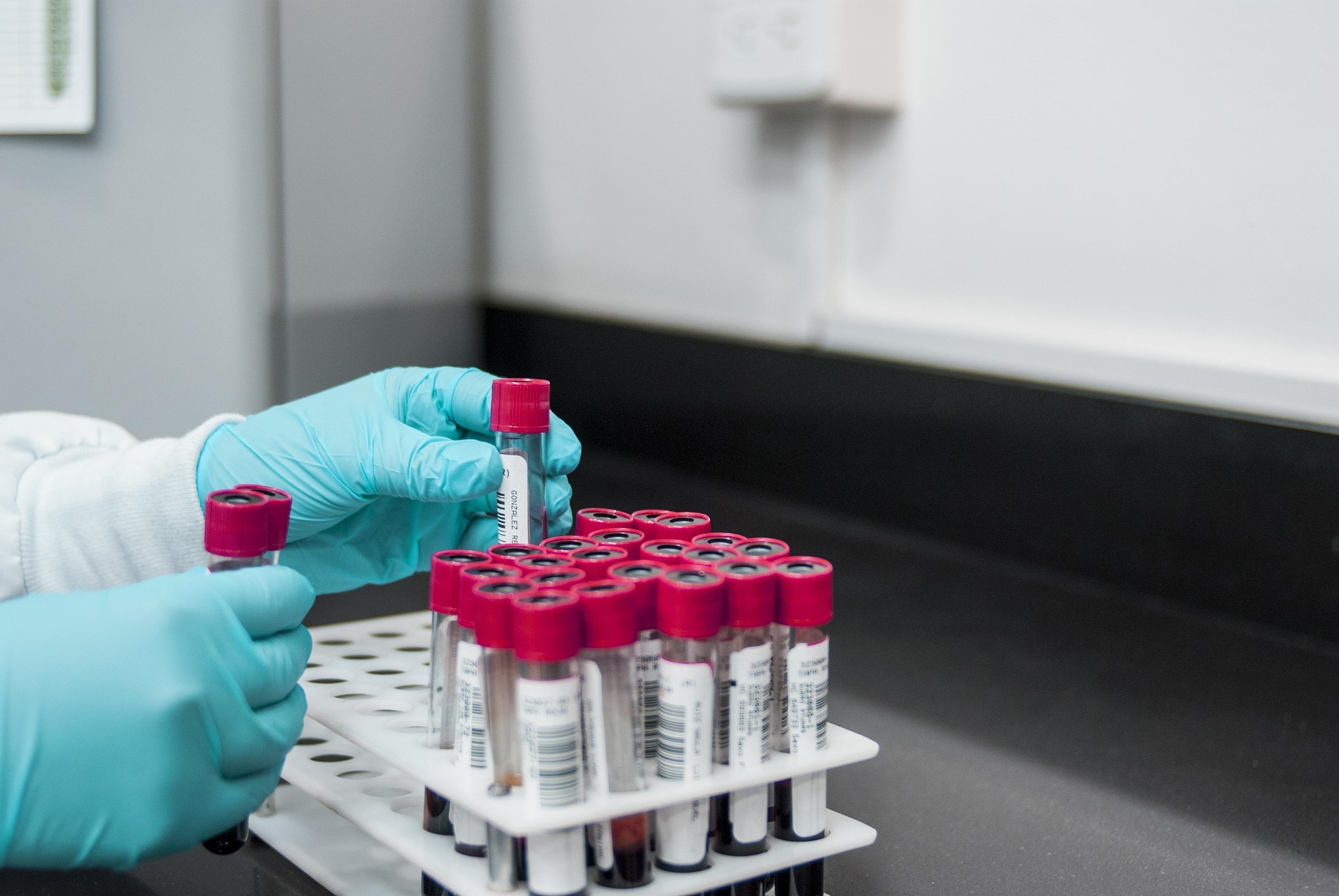 Ống nghiệm, test tube, hóa chất, chemicals, nghiên cứu, research- fernandozhiminaicela