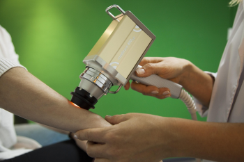 Trị liệu laser, handheld device, thiết bị cầm tay, skin treatment, điều trị da, clinical session, da liễu -  AlarconAudiovisual